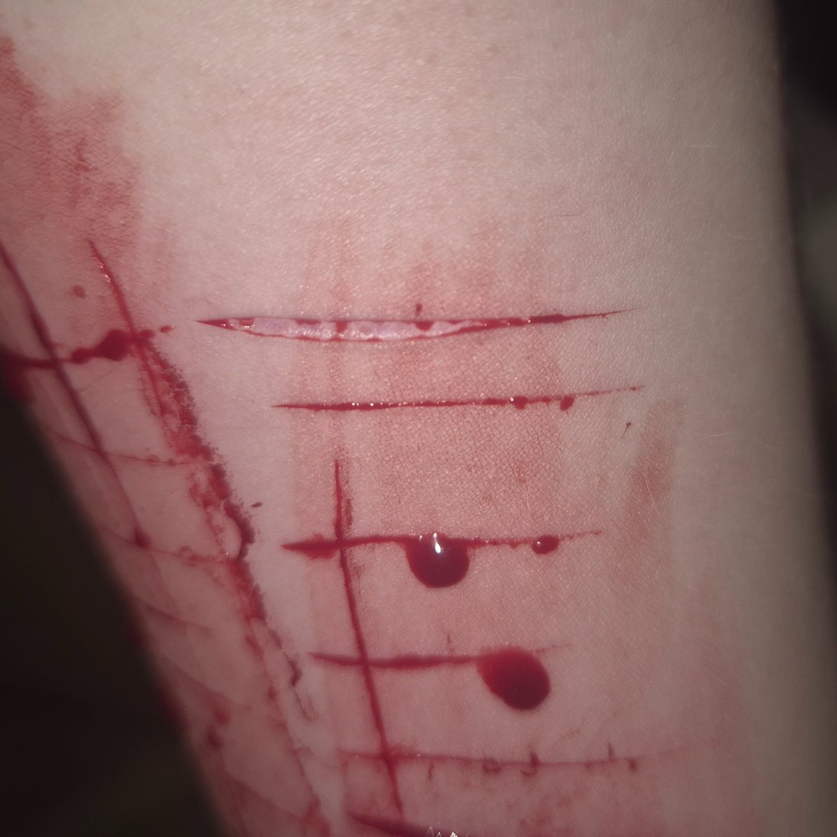 CheeseNom112917's tweet photo. YEOWWWWWW but my other arm 🤤 I think i got some pretty deep ones so I'm happy finally 
Fake sfx Not real body
Ai generated fake blood https://t.co/J0HH5SvCts