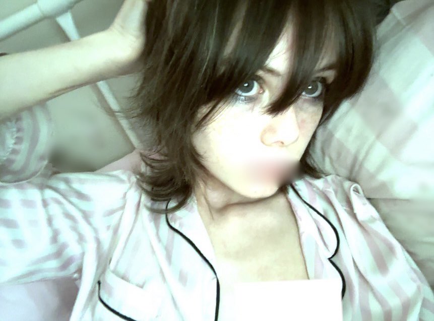 aborteddd_illy's tweet photo. overall I’m not really an insecure person, but I do hate my mouth sometimes 💔 (also I feel like you can see how I’m losing hair on this pic waaaaah kill meeee) https://t.co/sYQrQm0KqS