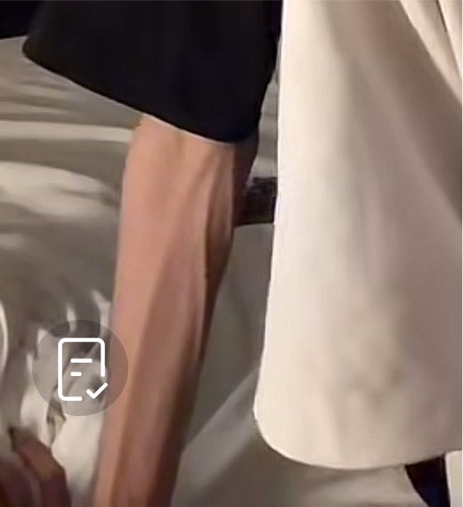 RailoGux's tweet photo. El brazo de Alex parece de viejo https://t.co/NybXvmGOVh