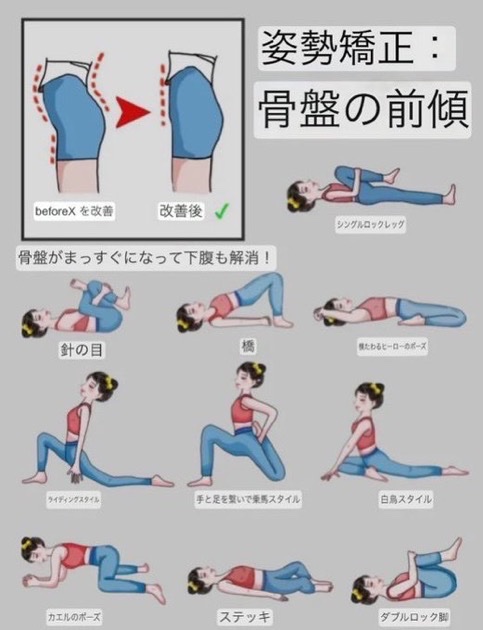pokopoko_wonaka's tweet photo. 女性特有の骨盤が前に倒れて反り腰になって下腹出てる人は今すぐこれで治して！！
このストレッチ寝る前かお風呂上がりにやってるけど横から見た時の姿勢と下腹ぽっこりなくなるからオススメ！！ https://t.co/gH3QN4LwOZ
