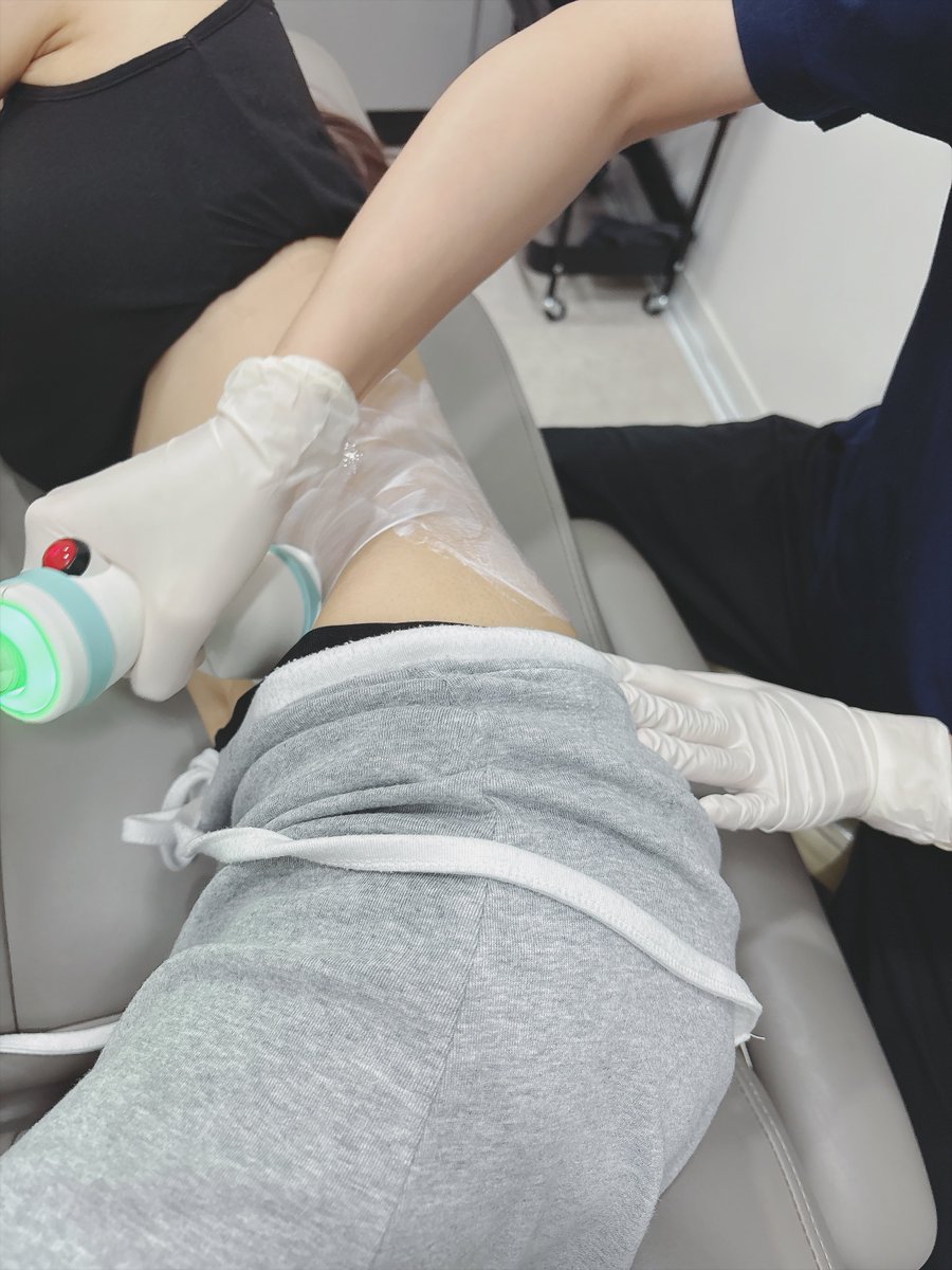 ams2tae's tweet photo. 院長「どこの部分が気になりますか☺️？」
ワイ「私、ジェニになりたいんです❣️」

ありがとう…院長先生…
明らかにビフォアフが違うょ、、なんか腹筋にすら見えてきた、、
気づけば持っているTシャツは全てクロップ丈。
来月の日本旅行を無双する為に駆け込みボディオンダ。
このチェーンの中でも一際クチコミの良いホンデシンチョン店…本当に良かった。

顔さえ見えなければ美女に見えない？
みんな、まだ間に合うよ。2026年のクビレ。

施術提供🏥you&i ホンデシンチョン店　PR