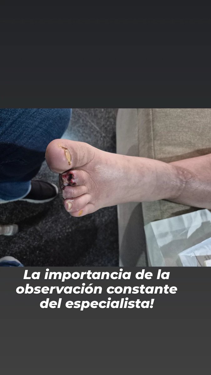 MolasFlorentin's tweet photo. #DRMOLASCIRUGIAVASCULAR_FLEBOLOGIA 
#Pie_Diabético_Molas_Py https://t.co/UTZZSMgFim