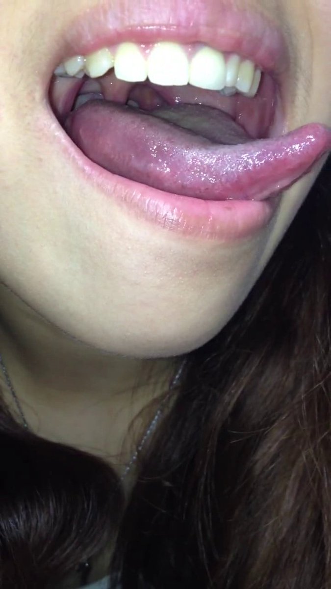 honmuster's tweet photo. 笑った時にのどちんこが見えるということは、彼女の喉の開口部が非常に大きい可能性が高いことを示す良い指標です。 https://t.co/bElplKQ9Hm
