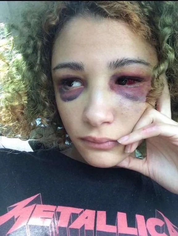 unhingedmisery's tweet photo. She deserved far worse..those black eyes are so fucking hot tho https://t.co/kdZJHfQBUj