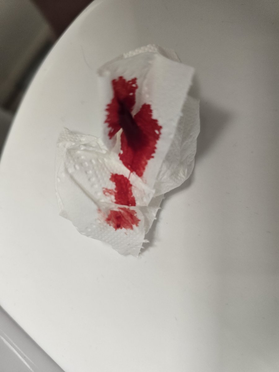 plannedscar's tweet photo. (SFX MAKEUP! Special effects makeup for a horror movie! All fake dont try at home!!) #fakeblood https://t.co/lDZQk6H2Fw