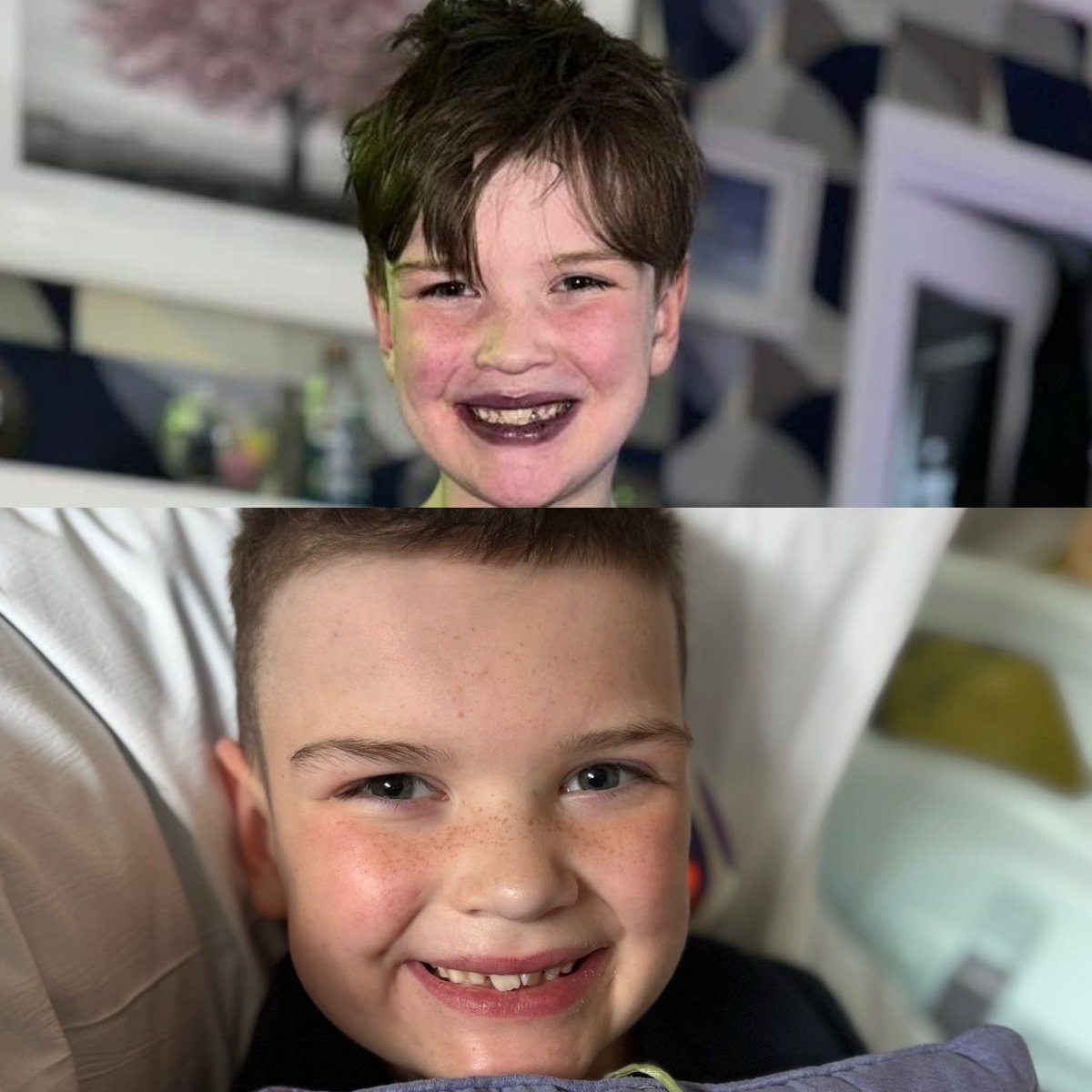 Donate4Daithi's tweet photo. The power of organ donation in one photo. ❤️

Well… two photos. Just one month apart.

We know there’s still a long way to go, but just look at what organ donation has already made possible. https://t.co/jUhU9AZbZY
