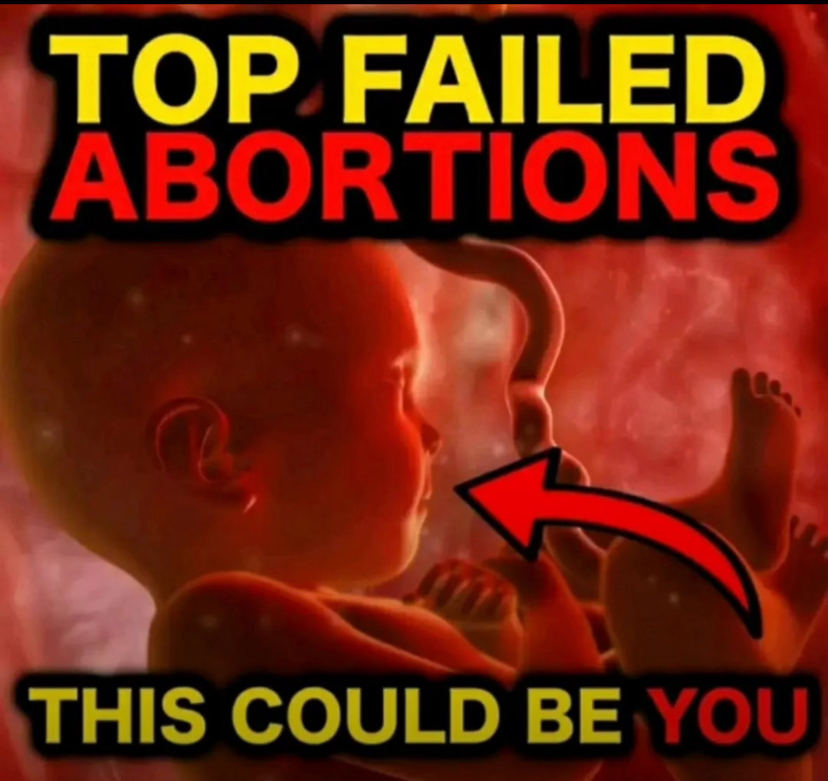 IReignSuprm47p's tweet photo. @Keagune @phil94665964071 @PinkCarmel73217 @Haster18_ not even a burner, look at you projecting again like a dumb fucking retarded bitch you are https://t.co/Y842IvARen