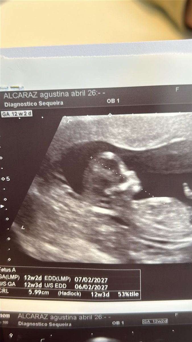 Agusalcaaraz's tweet photo. El perfil que me volvió loca de amor😍 te esperamos Con mucho amor bebé
Queríamos hacerte una revelación pero mamá ya supo que eras desde que te vi jajaja te amo amor de mi vida❤️‍🩹 https://t.co/bagdLx9cWf