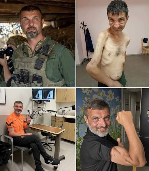 mr_twisted_'s tweet photo. In 2022, Ukrainian marine Mykhailo Dianov became one of the most recognizable defenders of the Siege of Mariupol during Russia's invasion of Ukraine. 

While fighting to defend the city, he suffered a devastating gunshot wound to his arm but continued resisting alongside his fellow soldiers at the Azovstal steel plant.

After the city's fall, Dianov was taken into Russian captivity, where he spent months in harsh conditions with little medical treatment. 

Photos released after his capture showed how severely he had deteriorated, shocking people around the world.

In September 2022, he was freed in a prisoner exchange and returned to Ukraine. Thanks to donations from supporters, he underwent multiple surgeries and extensive rehabilitation. 

His remarkable recovery transformed him into a powerful symbol of resilience, hope, and the strength of the human spirit, inspiring millions both in Ukraine and around the world.