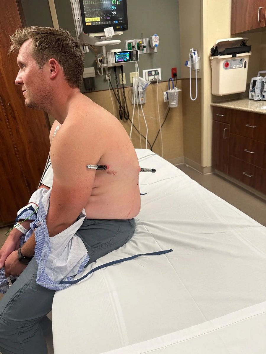 DrEricDing's tweet photo. HEALTHCARE IS TOO DAMN EXPENSIVE—Hiker walks 10 miles down Montana’s tallest mountain after impaling himself on a pole, hoping to avoid a costly helicopter evacuation.  On July 20, 2026, David Cifaldi was ascending the 12,803-foot Granite Peak, Montana's highest mountain, with two friends. Around 11,800 feet into the climb, Cifaldi slipped on loose rocks. During the fall, he landed on one of his trekking poles, which pierced his torso—entering below his left armpit and exiting through his lower back. Roughly 8 of the rod remained visible, protruding from his body. Nobody wants to forfeit their entire annual income for a rescue helicopter. Cost of healthcare is too damn high.