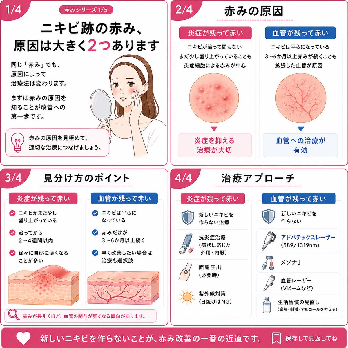 dr_manami's tweet photo. ニキビ跡の赤みは、実は原因が2つあります。炎症が残って赤いのか、血管が残って赤いのかで治療法は変わります。まずは赤みの原因を知ることが改善への第一歩です。 https://t.co/se0e8gzO49