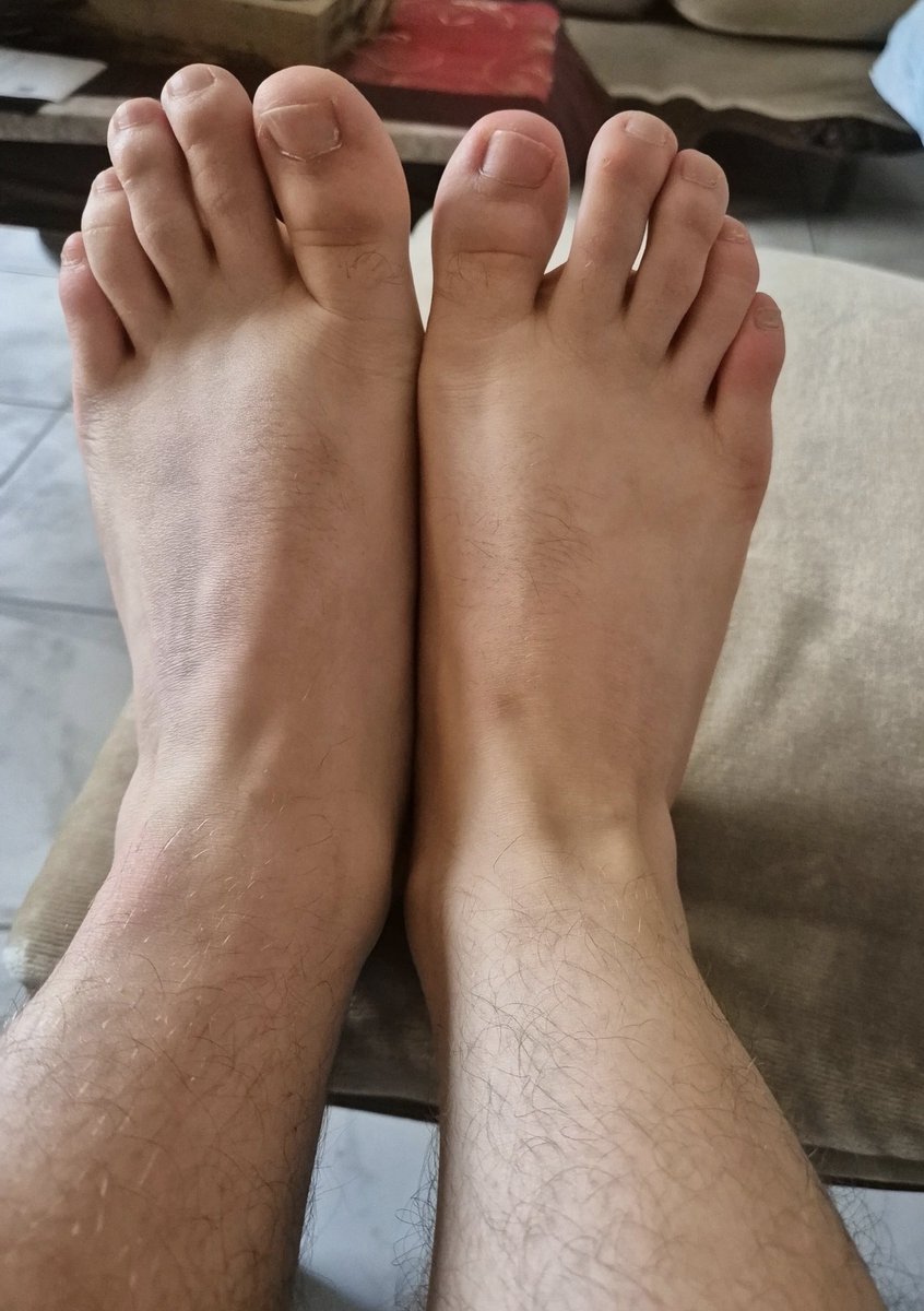 majohn1997's tweet photo. #gay #feet #gayhomemade  #gayest #gaygreece #feetfetısh #feetworshi̇p  #feetgreece #toes #Gayporn #gaysex
#gayhairry #gaylife #stripchat https://t.co/NwTeru87qe