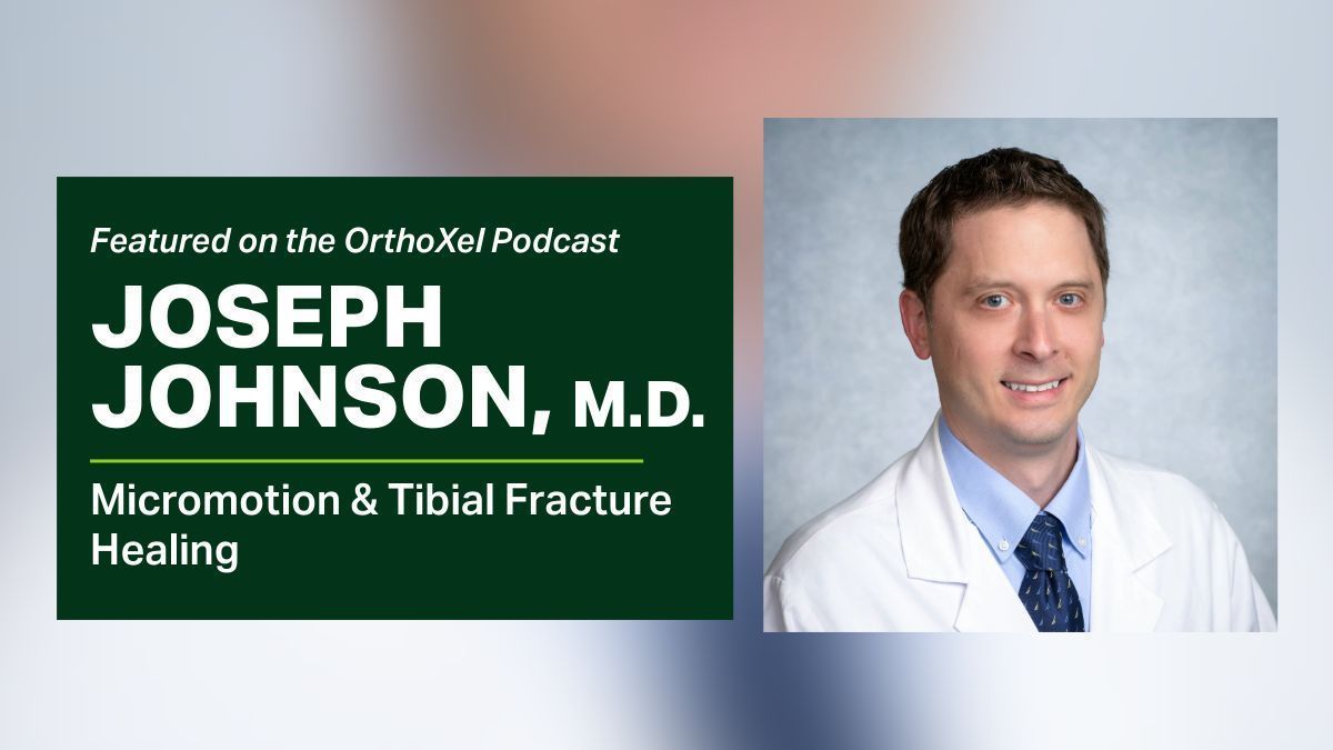 UABOrtho's tweet photo. We're proud to see Joseph Johnson, M.D., featured in this podcast discussing his early clinical experience in an ongoing randomized clinical study. Thanks, @OrthoXel, for sharing his insights! @UABHeersink

🎧 Listen: https://t.co/AcHiCMJdfN 
▶️ Watch: https://t.co/H0PlkZxpgz https://t.co/Ya3ITXduCF