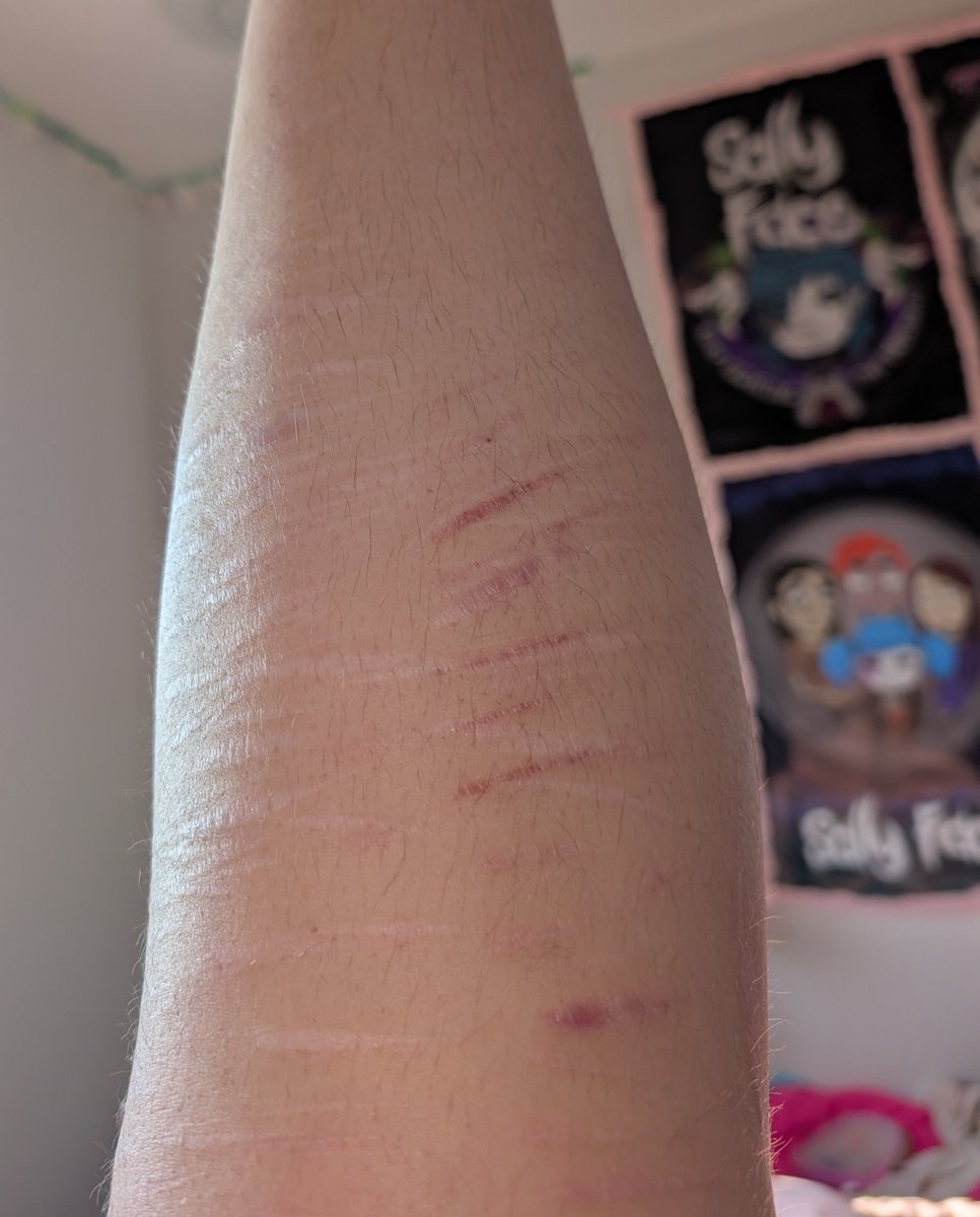 Mr_Max742's tweet photo. #scars #shtwt #shedtwt  sorry you got some bush action https://t.co/pfnwKXtrWF