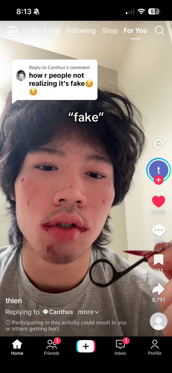 macaroniniii's tweet photo. I seriously hope he’s okay but why post this on TikTok https://t.co/yF40CJCHR4