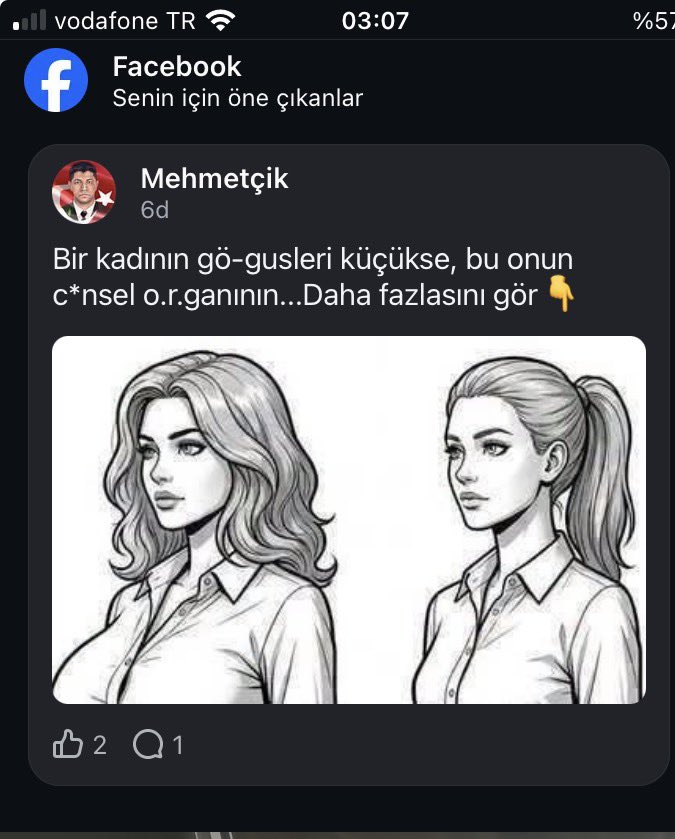 kerwmke's tweet photo. peki gö-gus uçları açık renkse https://t.co/FOOTTeRMji