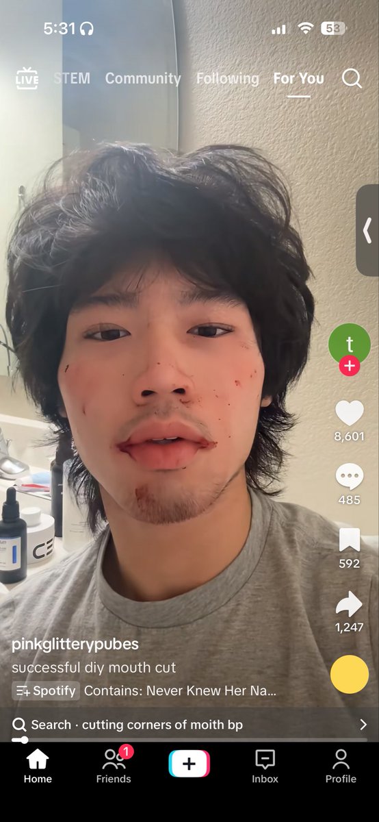 abssolootyl's tweet photo. holy shit as if he wasn’t ugly enough before #thein https://t.co/wwu7Xk1Mj6