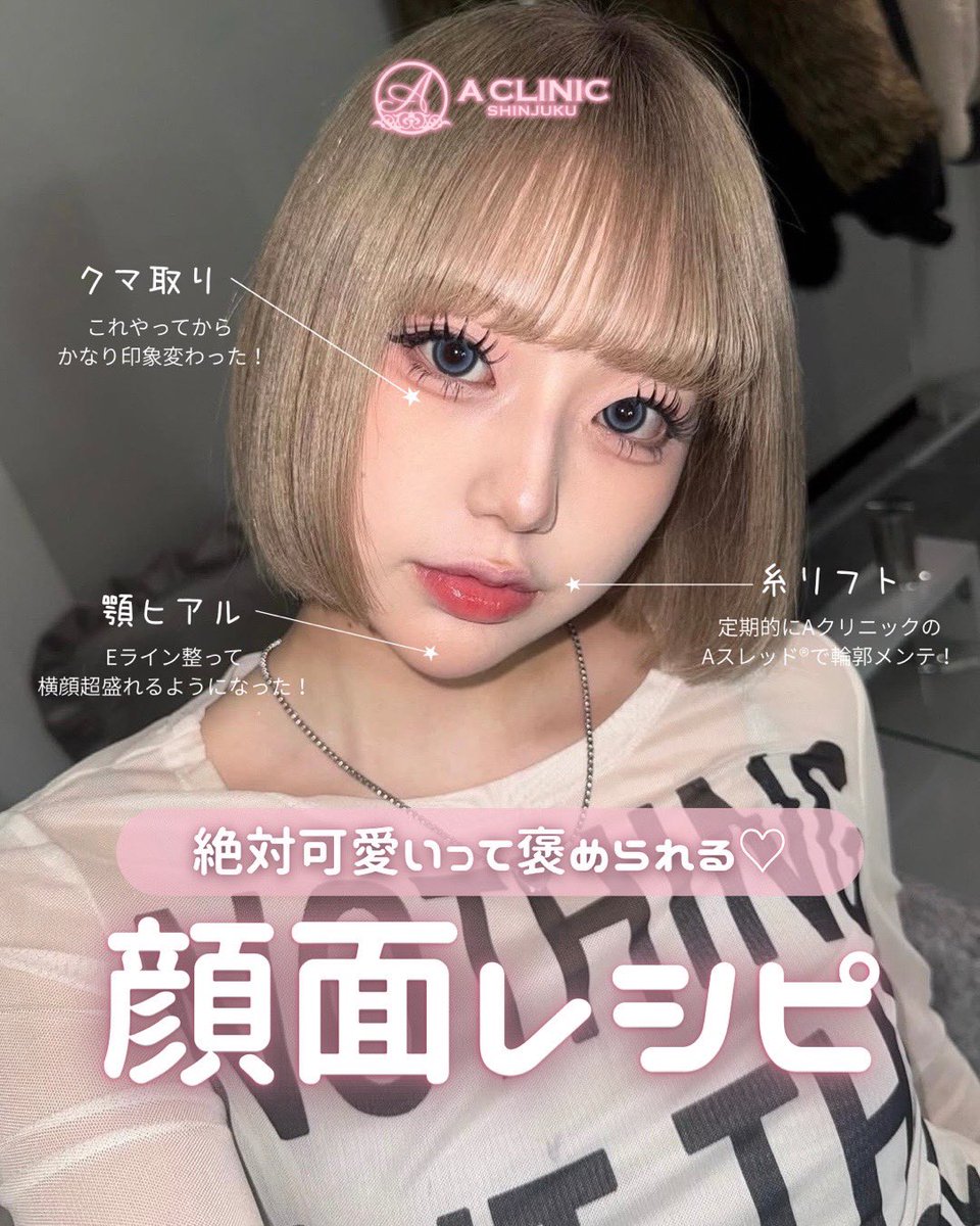 ACLINICSHINJUKU's tweet photo. まだ写真加工してるの？？
無加工でも自撮りが最強に盛れる秘密...ᐡ ᴗ̤ ̫ ɞ̴̶̷ ᐡ🤍

『Aクリの周りにバレない顔面アプデ🪄︎︎✨』
ダウンタイム最小限だからこそ叶う。
周りにバレずに垢抜けしたい人、ダウンタイムが取れない人は
是非Aクリニックへ💨💨

↓可愛い子の顔面レシピ https://t.co/i6m4bklX9L
