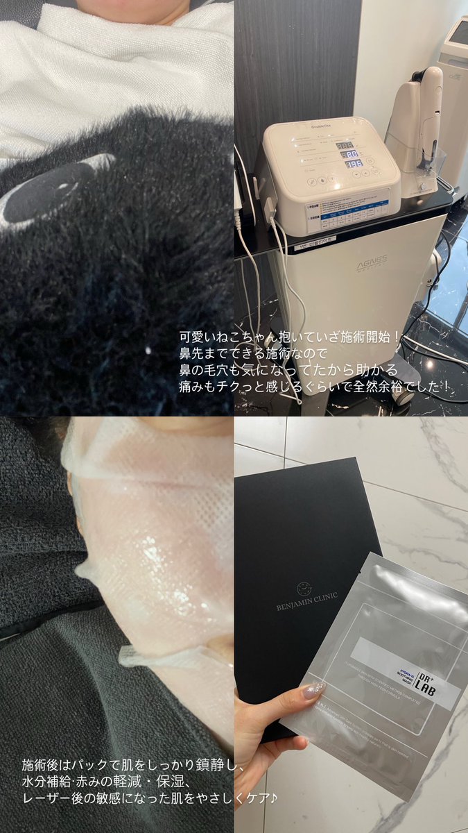 me_you_41's tweet photo. 皮膚科専門医のベンジャミンクリニックさんでダブルタイト+マスクパックの施術を受けてきました☻

初めて聞くダブルタイトという施術ですが、
おもに
・たるみを引き締めてリフトアップ
・フェイスラインをすっきり整える
・ハリ・弾力のある肌へ導く
などの効果が！！！

リプ欄へつづく↓ https://t.co/Jg2qlFcTgA