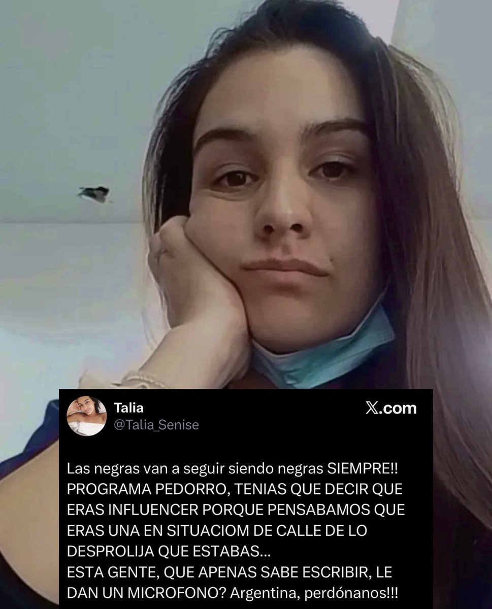 delfinawagner_'s tweet photo. 🚨Esta es Talia Senise, la enfermera racista del Hospital Nores de Tigre que admitió no revisarme correctamente y negarme una atención médica digna porque pensó que yo estaba en situación de calle porque salí corriendo al hospital sin producirme luego de un accidente. DIFUNDAN👇🏻 https://t.co/OS5nkCbYN1