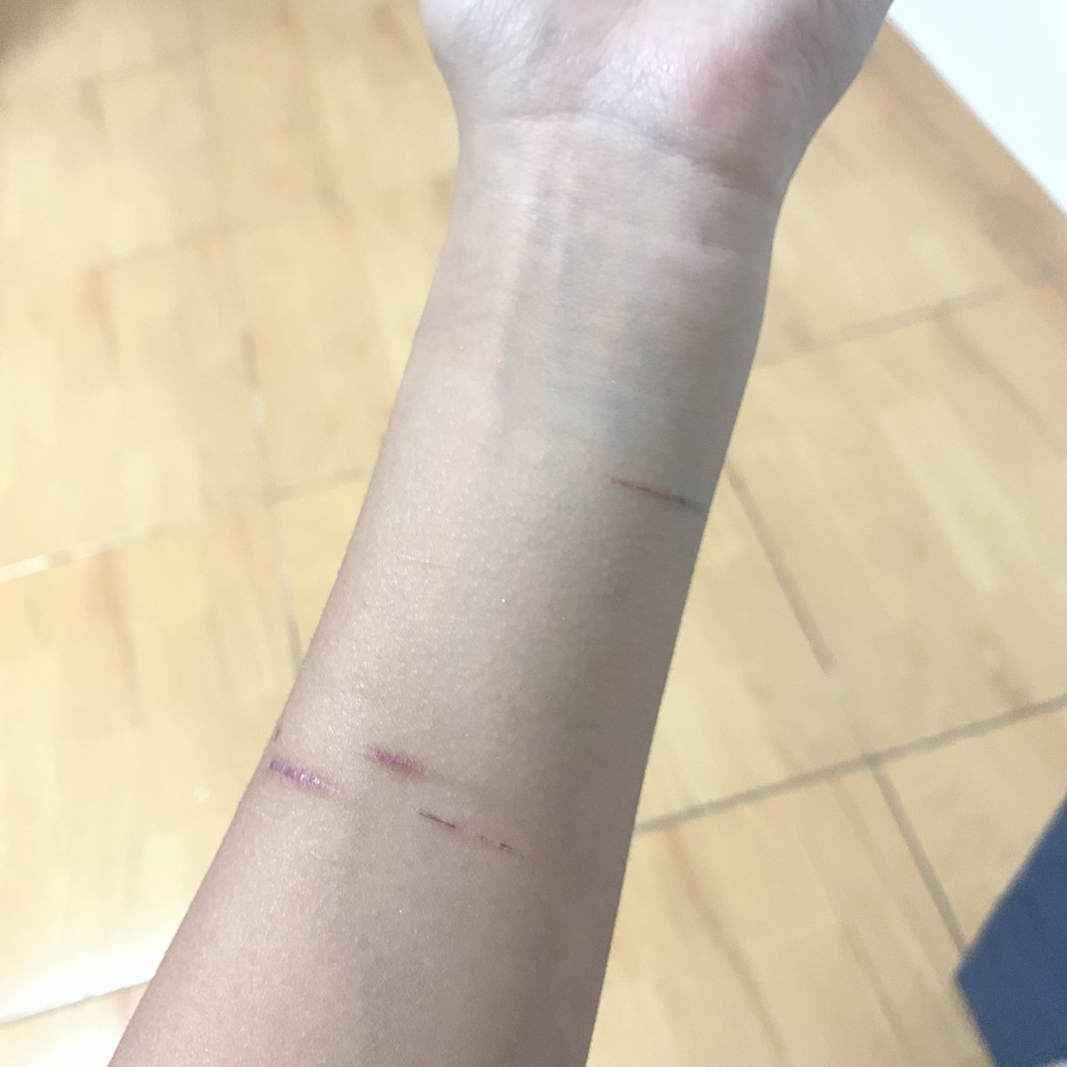_sylkwbz's tweet photo. Ya paso un mes y no se vuelve cicatriz 🥀 #fakebody #fakearm #makeup #shtw https://t.co/HPA01LQANw
