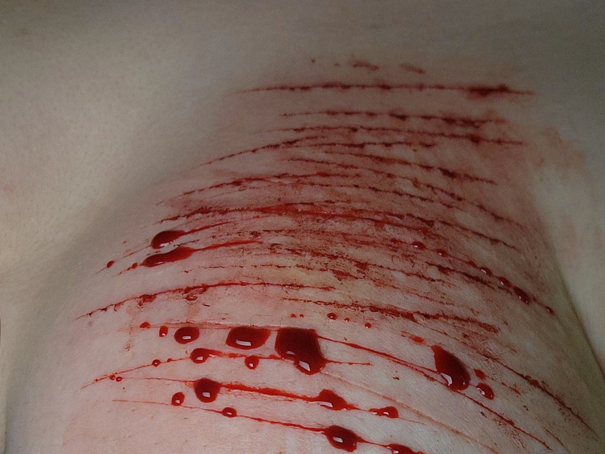 Layla7063's tweet photo. Some makeup practice from a few days ago! I’m really proud of this special effects #sfx #shedtwt
The tits look really nice like that? https://t.co/2gyuHNAp1B
