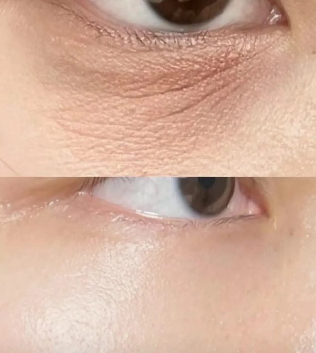vanwillsleep's tweet photo. Saran dari sepupu aku, kata nya kalo buat mata panda itu pakai cream yg ada kandungan haloxyl nya tapi kalo buat garis halus pakai yg ada kandungan peptide..

Dan gong banget, aku pake yg udah mengandung haloxyl+peptide baru dua minggu udah keliatan banget beda nya 🥹😭🫶🏻￼ https://t.co/gWWBkKEfKh