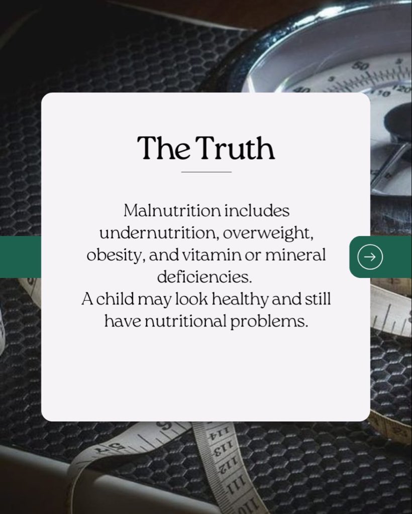 b_c_n__i's tweet photo. A child can look healthy—or even overweight—and still be malnourished.
Malnutrition includes undernutrition, overweight, obesity, and vitamin/mineral deficiencies.
💬 Did you know? Share your thoughts!
#MythBustersWednesday #BoyChildNutrition #MalnutritionAwareness https://t.co/6YT0hAPtF0