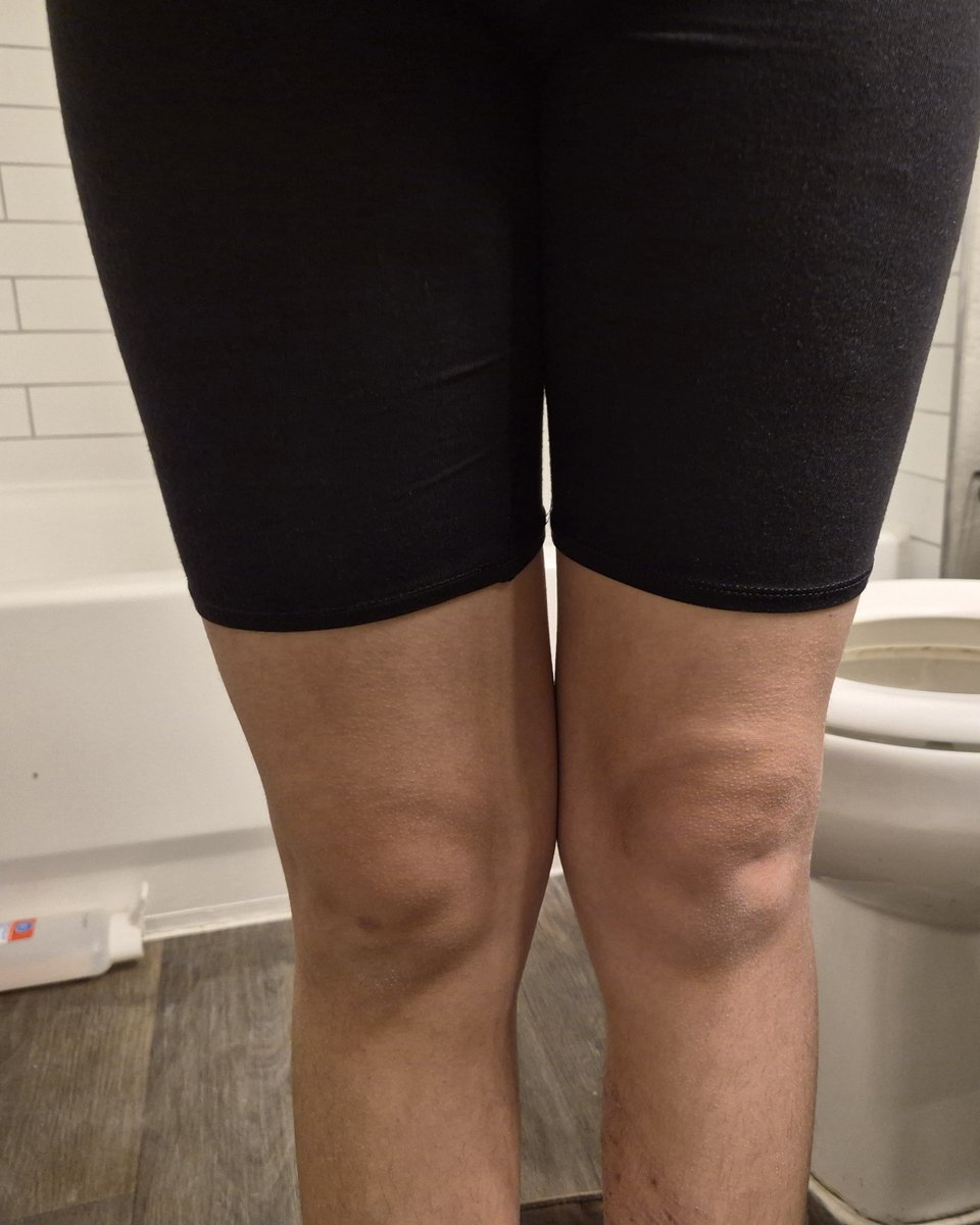 IMABIGFATRAT67's tweet photo. Im genuinely so fatspo it makes me want to kms. #fatspo #edrtwt #grosspo #ed #shedrtwt https://t.co/qxBRxe6Ym2