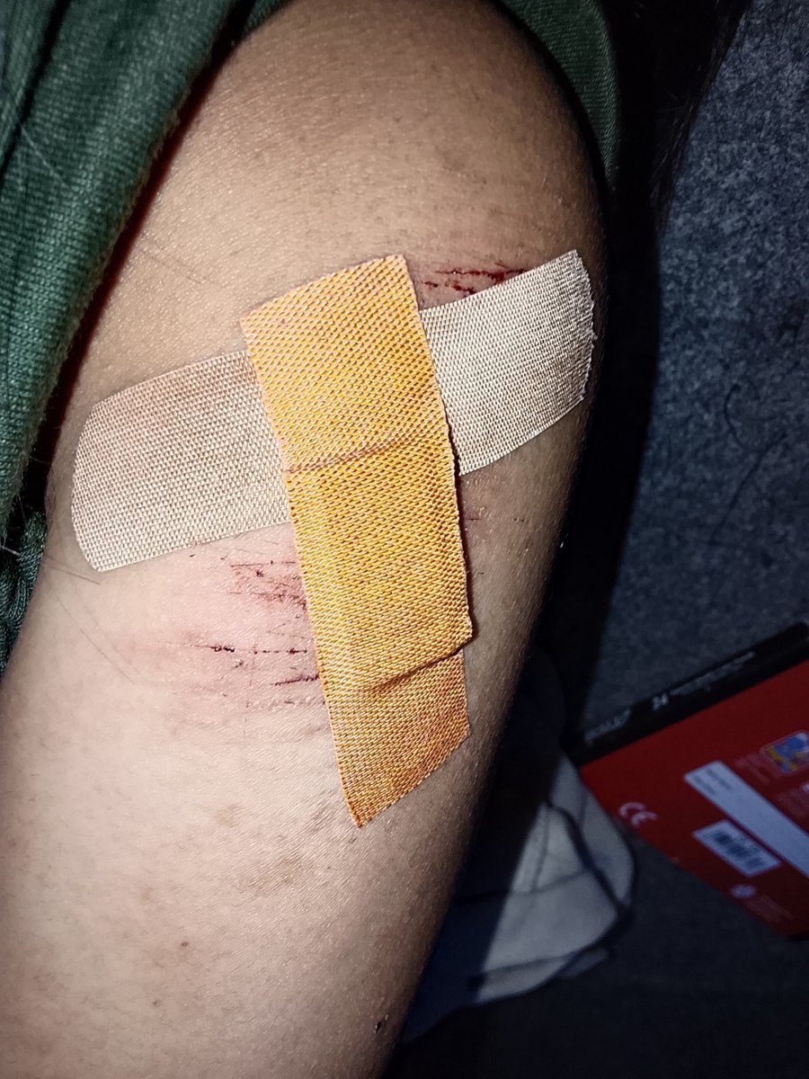 solspun's tweet photo. i hate twitter. (but i love it sm ughh..)
anw hiyaaaa guyssksjss check out my cool aftercare! so  properr, rightthtthhthtttt???
fake body fake everything just makeup fake band aids or sum shi https://t.co/KYntwM4rSu