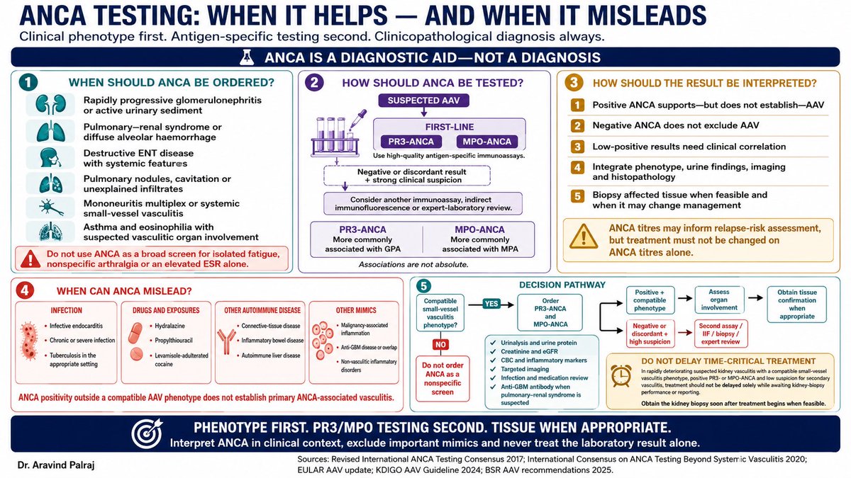 Rheumat_Aravind's tweet photo. ANCA is a powerful diagnostic tool—but only when used in the right clinical context.

A positive ANCA does not diagnose ANCA-associated vasculitis, and a negative ANCA does not exclude it.

This infographic summarizes when to order ANCA, how to interpret PR3-ANCA and MPO-ANCA, common diagnostic pitfalls, and why clinical phenotype always comes before laboratory results.

Interpret the patient—not just the antibody.

#Rheumatology #ANCA #Vasculitis #MedEd #EvidenceBasedMedicine @IhabFathiSulima @docakx @vasculitisES @anzvasc @IRAeNewsLetter