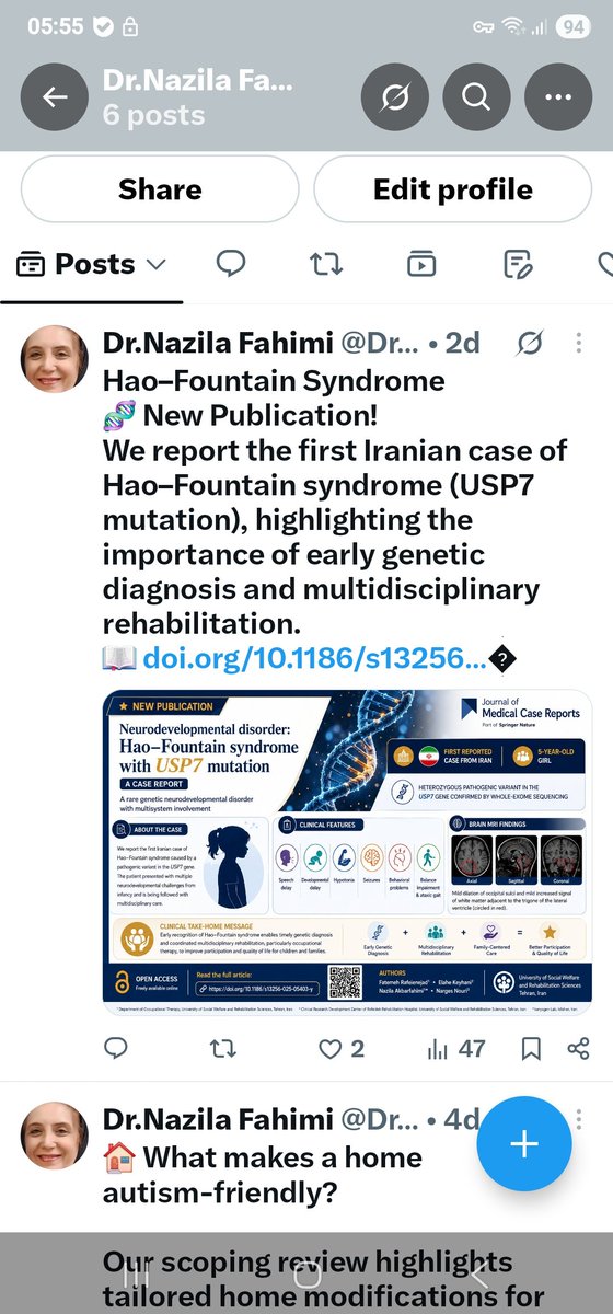 Dr_NFahimi's tweet photo. We report the first Iranian case of Hao–Fountain syndrome with a USP7 mutation, highlighting the importance of early genetic diagnosis and multidisciplinary rehabilitation in rare neurodevelopmental disorders.
#RareDisease #Rehabilitation 
DOI:https://t.co/IxpDfE4eWK https://t.co/UY7x8Noock