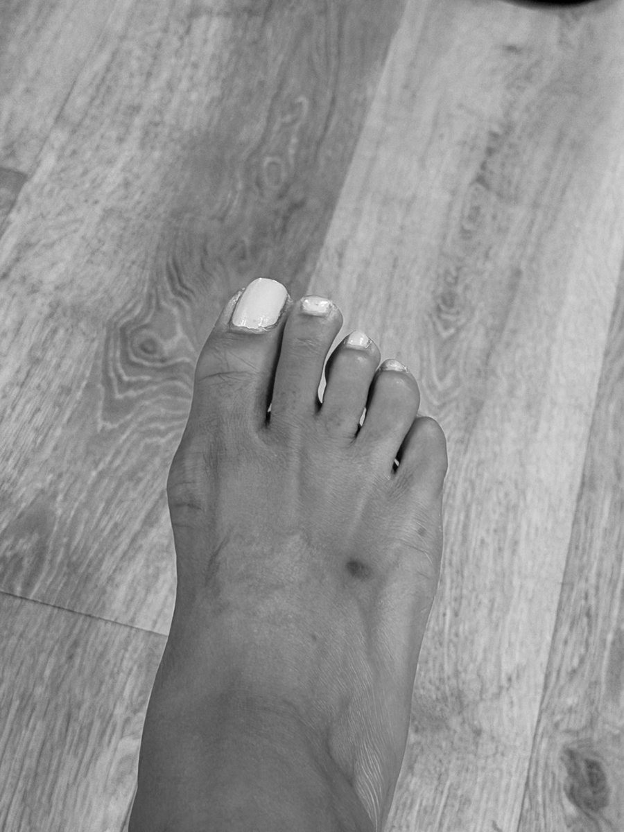 greenlillytoes's tweet photo. Natural #feet #toes #findom https://t.co/agqV8IDhCx https://t.co/FVh8XvMxrG