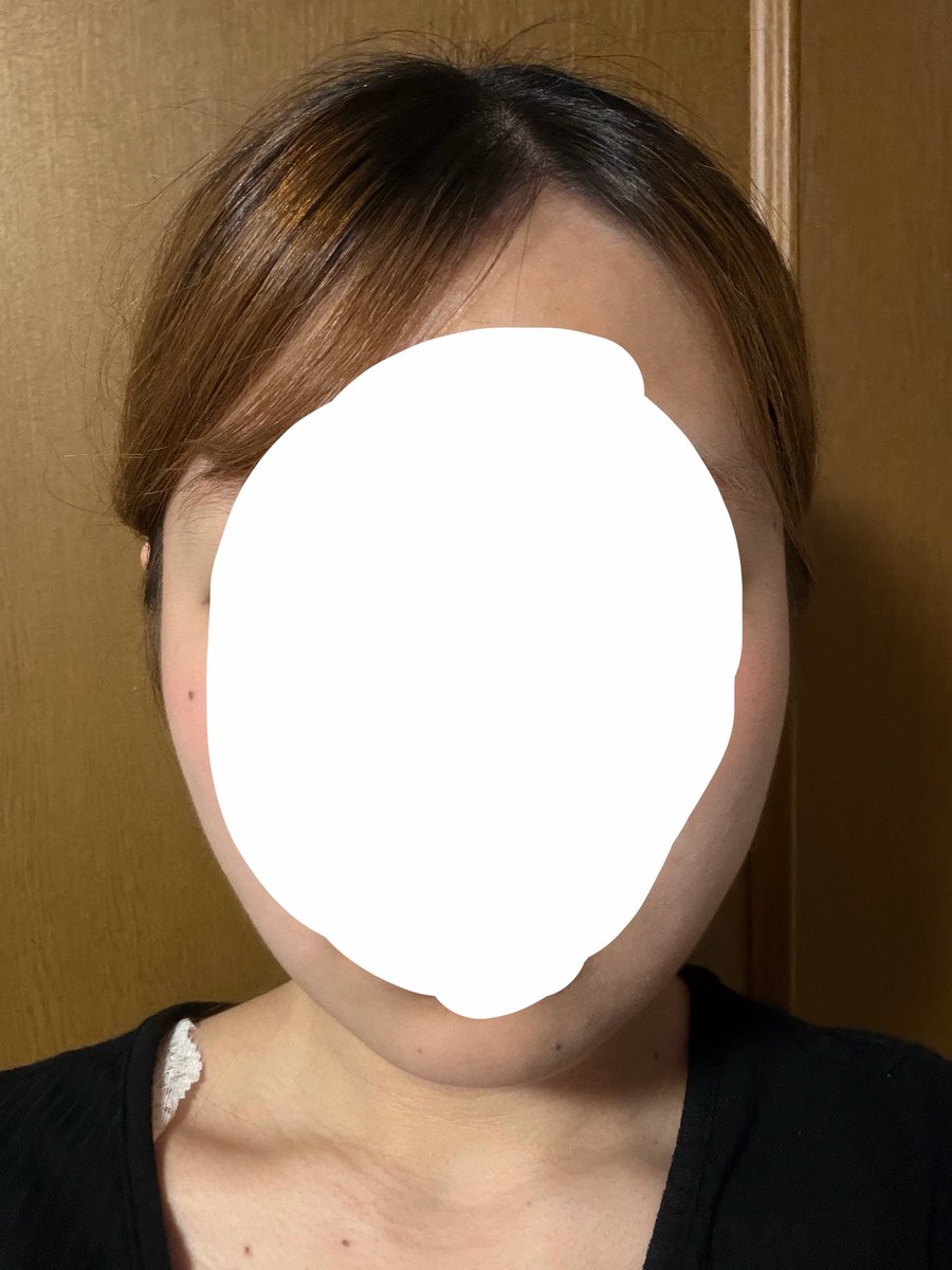 0cm_rice's tweet photo. 2週間🙃 https://t.co/sSoDHcq8DQ