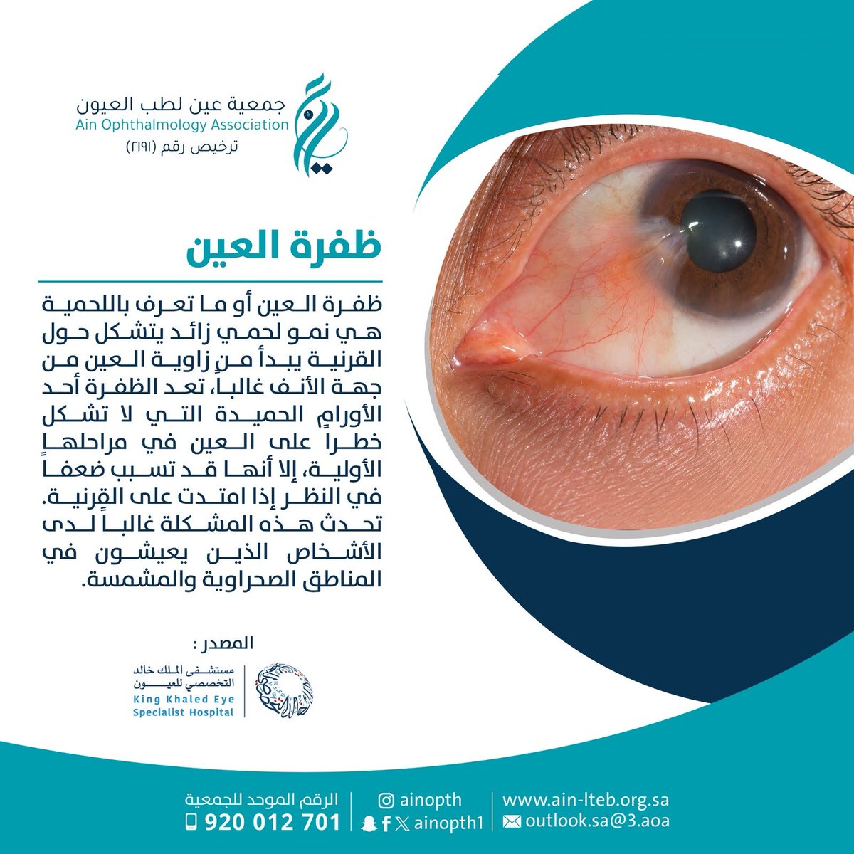 Ainopth's tweet photo. #توعية
.قد تبدو ظفرة العين بسيطة في بدايتها، لكنها قد تؤثر على الرؤية إذا امتدت نحو القرنية. 
الوقاية تبدأ بالوعي، وحماية العين من أشعة الشمس والغبار، مع الفحص المبكر عند ظهور أي تغيرات، هي الخطوة الأهم للحفاظ على صحة البصر.
في #جمعية_عين_لطب_العيون
نؤمن أن الوعي هو أول طريق الوقاية.
#مكافحة_العمى
#معاً_نحو_الرؤية
#القطاع_غير_الربحي
