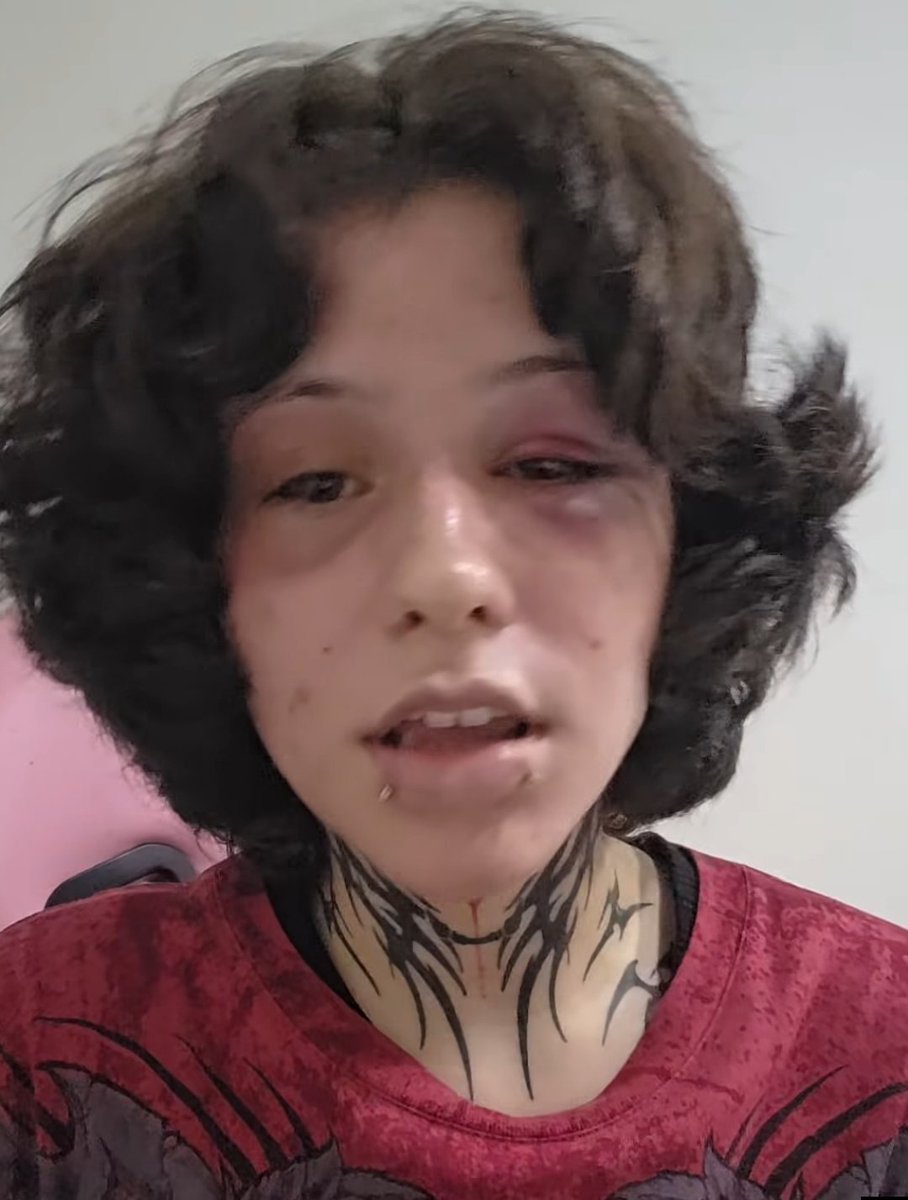 betao_creme's tweet photo. Desculpa ai mas pra nós homens tomar uma surra dessas é feião, se fosse mulher eu defendia. https://t.co/2BAH5QfvyG