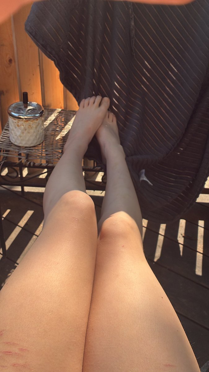 2manydarts's tweet photo. Anyone else embracing nudity recently😭 I’m trying to tan with no tan lines side not my legs look fuckinh huge https://t.co/XDV25A3OGH