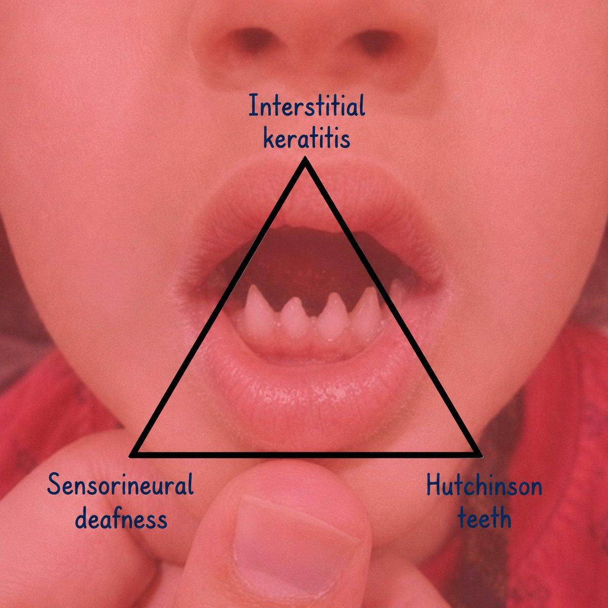TrackYourHeart's tweet photo. Can you name this TRIAD? https://t.co/OVDK8nUeQg