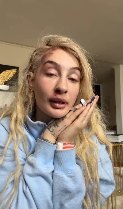 sviinxx's tweet photo. Pobrecita la Fran Maira, ame u odies a una persona no merece que le hagan esto, y el hijo de puta del nes como si nada subiendo canciones ugh y esto no es karma como dicen algunos, dejen de minimizar la situación, y si estás pasando por esto, no es fácil pero DENUNCIA 💜 https://t.co/Pq92uTK9kN