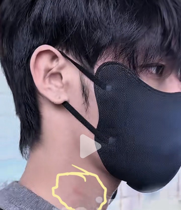 chusanluiyi's tweet photo. The hickey on Zhao Zhao's neck...

I knew it my dad is shameless he wouldn't leave my papa alone at night, not even when they're staying at my grandparents' house.

I'm so done. 😭  

#Hechangxi #heyanzhao #xizhao https://t.co/2Mhzo67waq