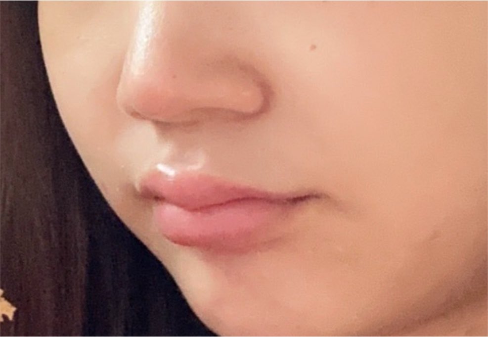 1465_btt's tweet photo. นี่คือสีปากของคนพึ่งตื่นนอนอะ ไม่ใส่ฟิลเตอร์ไม่ได้ทาลิป ลิปมันที่1ในใจยังไงก็ต้อง maxilip เมื่อก่อนแพ้ลิปหนักมากแห้งลอกจนแสบปาก ทาตัวนี้ทั้งวันไม่ถึง1แท่งหายแห้งลอก แล้วปากอมชมพูขึ้นด้วย 10/10 https://t.co/J7ZXbaosXp