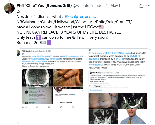 wheeloffreedom1's tweet photo. and... 🛰️, 6G⚡️#GutChip, #BiochipTerrorists🧐💻 have begun again!
They're so curious🧐 abt my morning bathroom use🚽💩🧻... 🚿
HOMOSEXUAL CREEPS! https://t.co/CzNxW0f8Ei