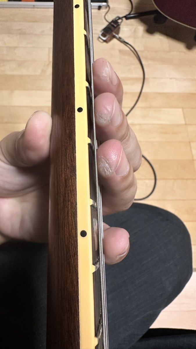 Akito08108's tweet photo. ギターだこができるぐらい弾いてるんだけどね、なかなか上手くならないんだよね😥 https://t.co/2ZCf22r6Ql