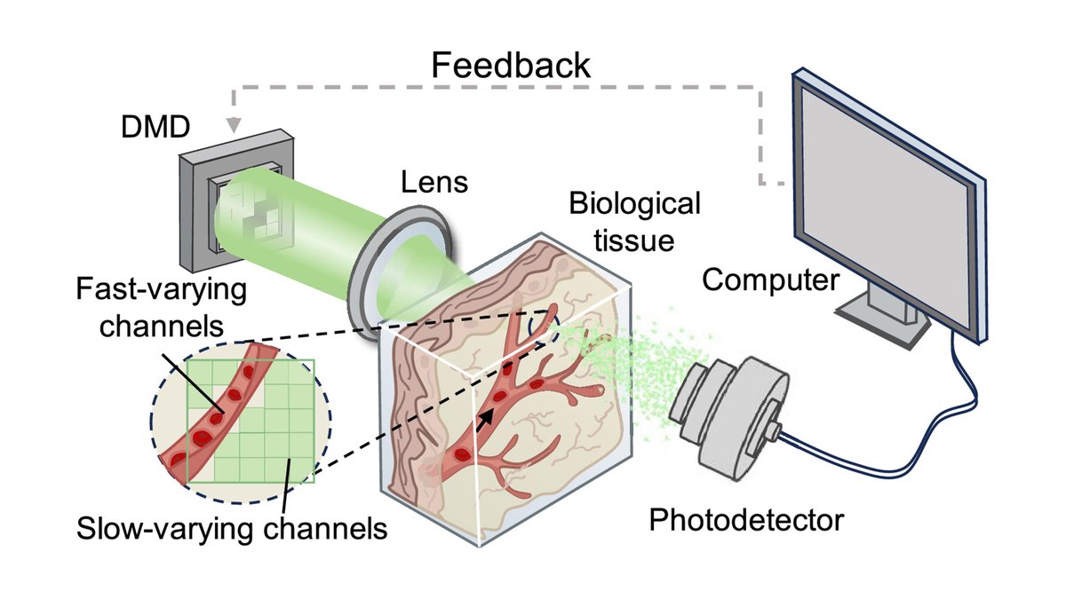 OpticaPubsGroup's tweet photo. An Editors' Pick via #OPG_BOEx: Focusing scattered light through live tissue with channel-selected wavefront shaping https://t.co/WKW3AfnFxa #OpticalScattering #OpticalManipulation @ECNUER https://t.co/zXB9fMtQ1Z