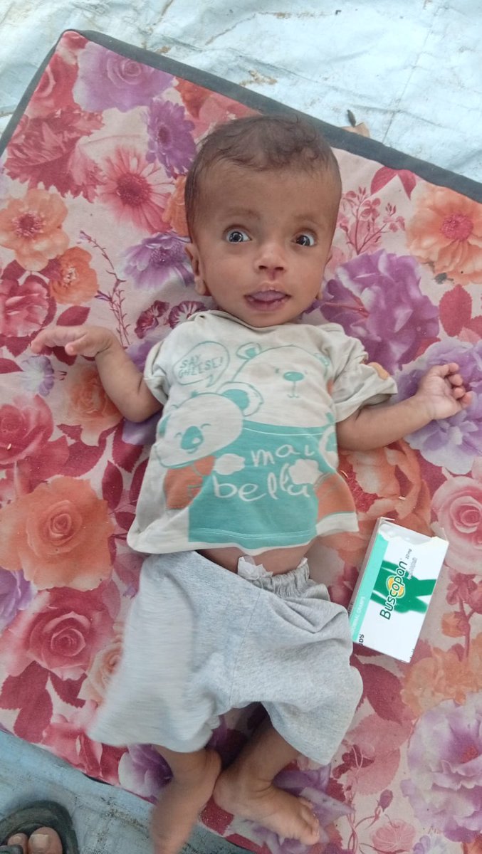 General78297611's tweet photo. Update ❤️

Thanks to 49 amazing supporters, we’ve raised €1,064 for Baby Malek.

We still have a long way to go. Please donate $5 or share his campaign.

Every act of kindness brings him closer to the treatment he urgently needs.
https://t.co/Nd9MN5b0gu https://t.co/4HykSXeXEk