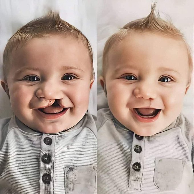 MelaniaFrance's tweet photo. Que Dieu bénisse les chirurgiens ! 🧑🏻‍⚕️🙌🏻🙏🏻❤️ https://t.co/Cph6cBsHdD