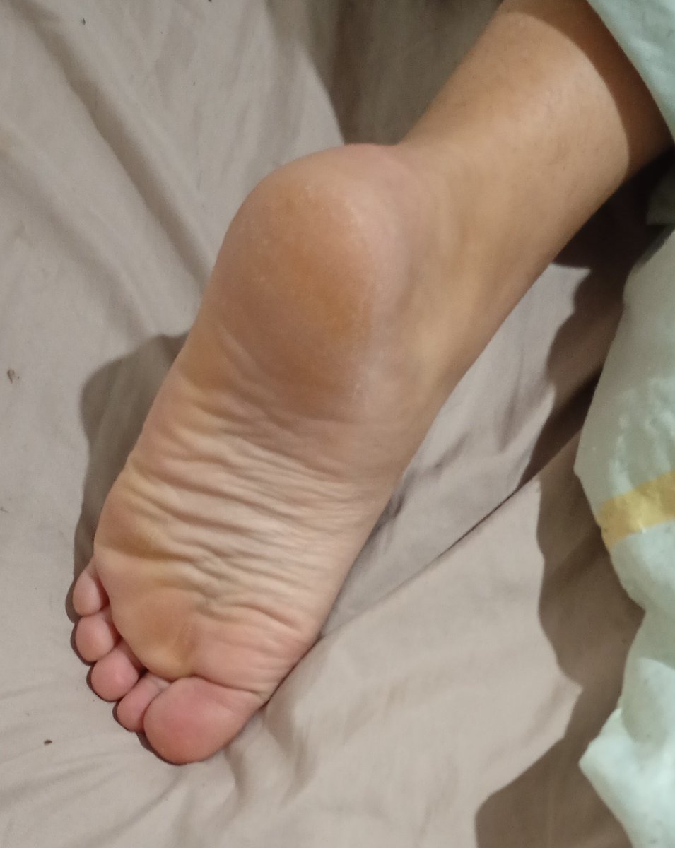 ubrsmhn31058's tweet photo. Solinhas e dedinhos da minha loirinha oque essas delícias merecem em comentem bastante #PINTOSAWARDSㅤㅤ #footjob #cumtributeِs #cumshoes #cumsoles #cumtoes #podolatria #podolatras https://t.co/TMSBrpk8EW