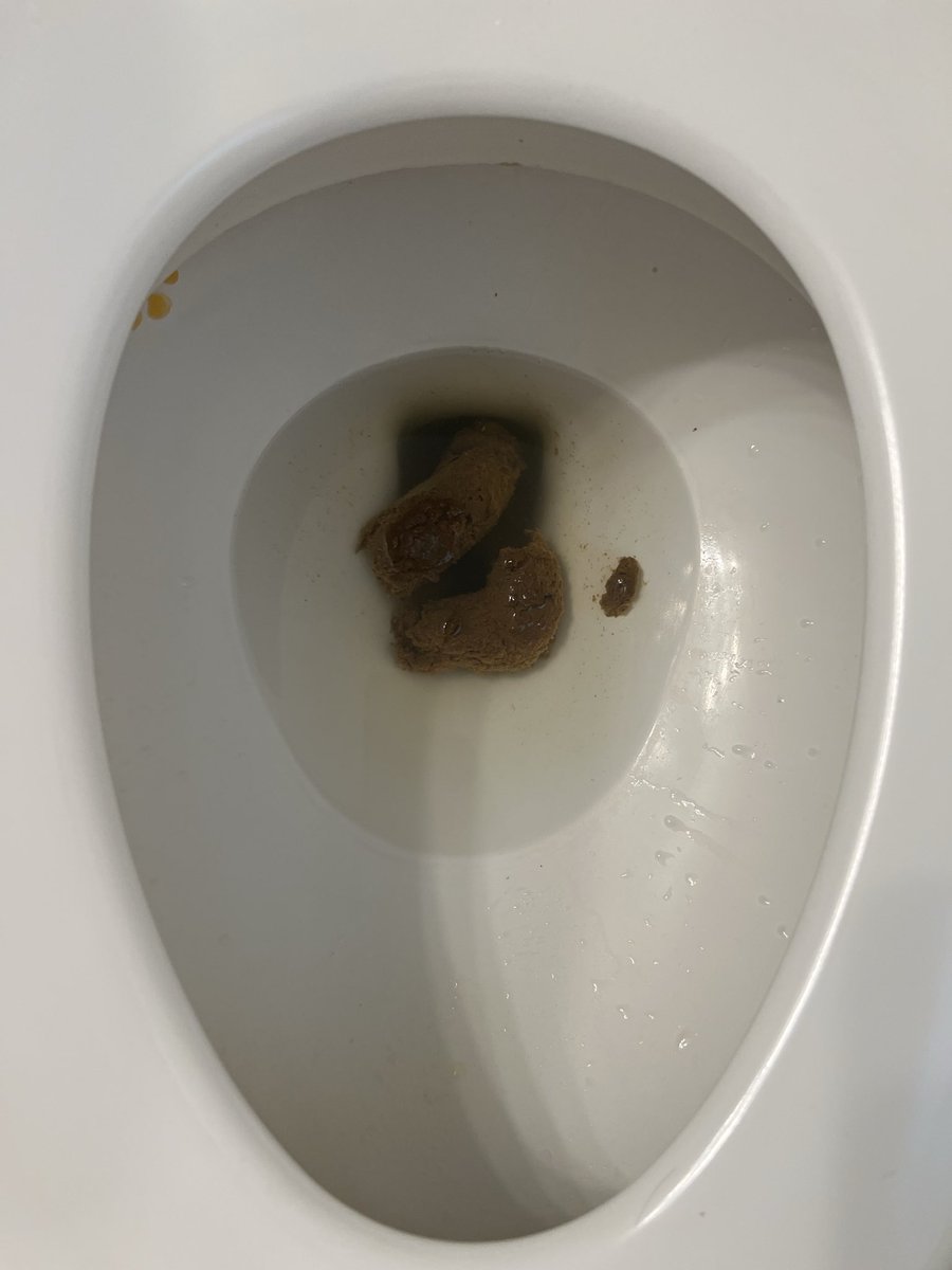 Vephrosmistess's tweet photo. Can someone clean my ass for me 😈#shitkink #poopkink #fartfetish #scat #fart #gassy #thick #bbw #poop #toilet https://t.co/LHbXzR1qsf