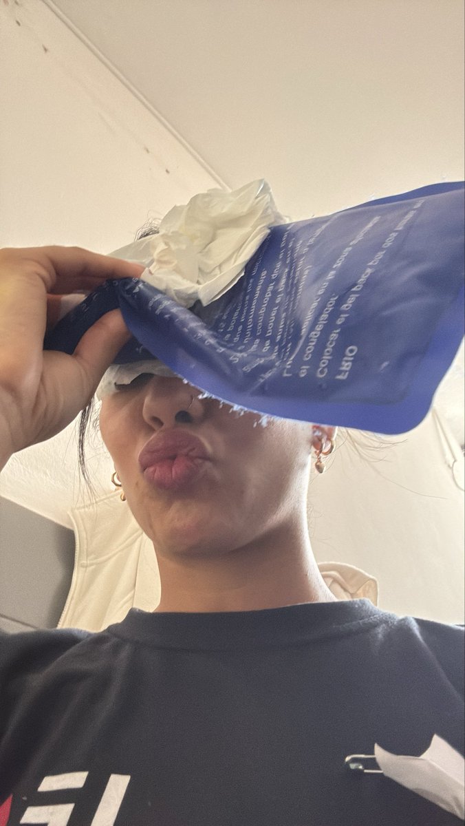 maytenunezt's tweet photo. Hoy me dieron una patada en la cara, literal. Unos cm más y tal vez que me quebraban la nariz, hielito y a dormir elijo creer no voy a amanecer con el ojo negro https://t.co/fCSdoj0Tiy