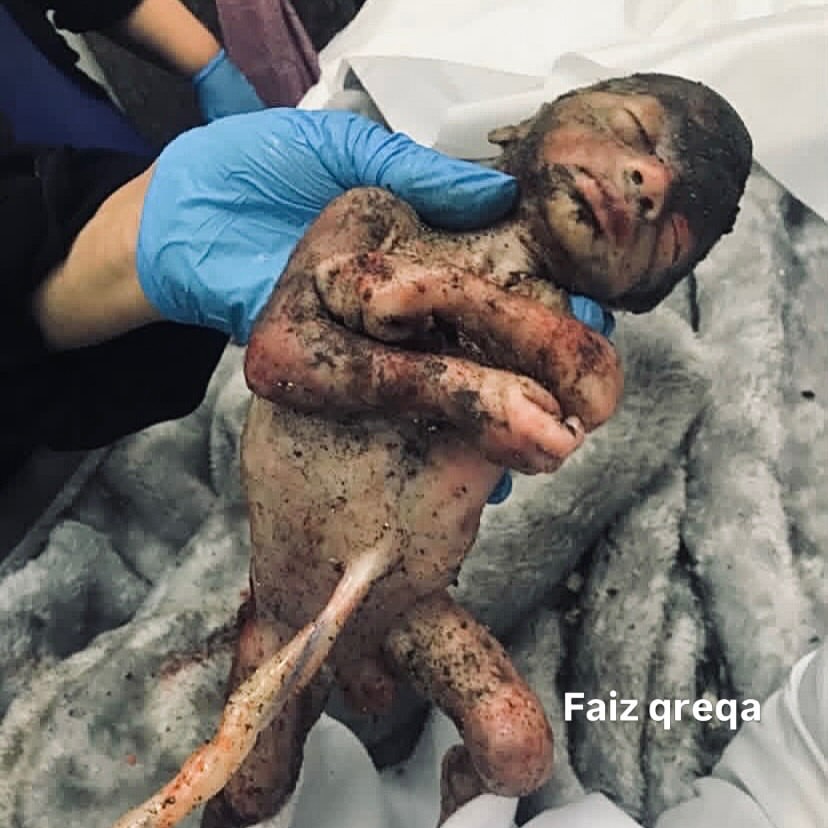xIsraelExposedx's tweet photo. 0 years old. Killed by an Israeli airstrike. His father, mother, and three-year-old brother were also killed. 

These are crimes against humanity. https://t.co/hYxRzI8UmS